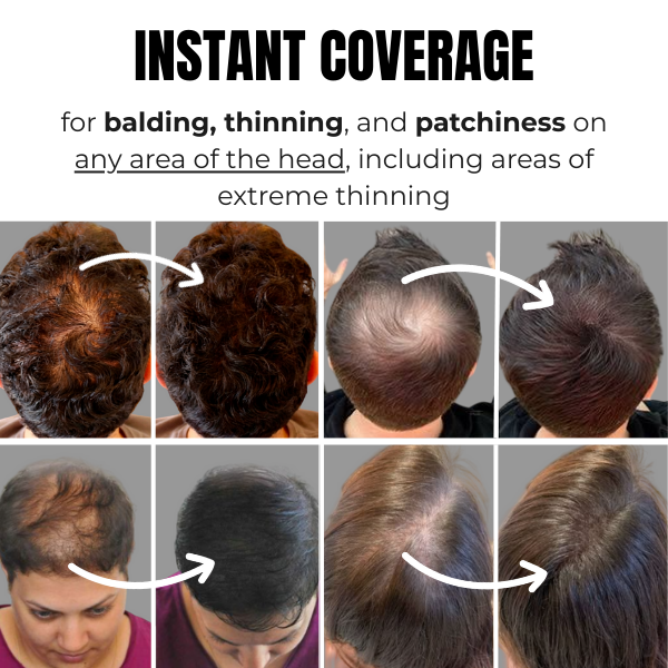 Ronwel™ Hairline Powder